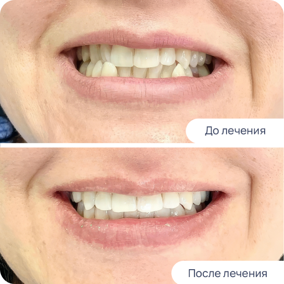 Заголовок